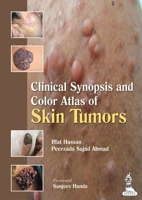 Clinical Synopsis and Color Atlas of Skin Tumors 9350909456 Book Cover