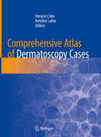 Comprehensive Atlas of Dermatoscopy Cases 3030083284 Book Cover