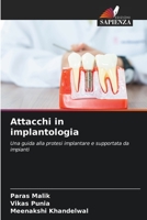 Attacchi in implantologia: Una guida alla protesi implantare e supportata da impianti 6206117359 Book Cover