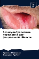 Везикулобуллезные поражения оро-фациальной области 6204087037 Book Cover