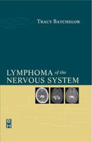 Lymphoma of the Nervous System 0750674067 Book Cover