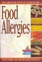 Food Allergies : Up-to-Date Tips from the World's Foremost Nutrition Experts 0471347140 Book Cover
