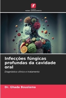 Infecções fúngicas profundas da cavidade oral (Portuguese Edition) 620819881X Book Cover