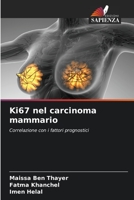 Ki67 nel carcinoma mammario: Correlazione con i fattori prognostici 6205266598 Book Cover
