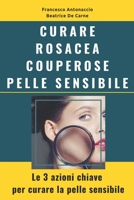 Curare Rosacea Couperose e Pelle Sensibile: Le 3 azioni chiave per curare la pelle sensibile 153277463X Book Cover