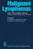 Malignant Lymphomas Other Than Hodgkin S Disease: Histology . Cytology . Ultrastructure . Immunology 3642810942 Book Cover
