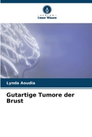 Gutartige Tumore der Brust (German Edition) 6207945824 Book Cover