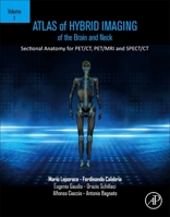 Atlas of Hybrid and Molecular Imaging: Anatomical Landmarks for Pet/Ct, Pet/MRI and Spect/CT Radiopharmaceuticals - Clinical Cases - Tricks and Pitfalls 0323904548 Book Cover