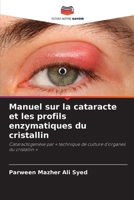 Manuel sur la cataracte et les profils enzymatiques du cristallin (French Edition) 6209593798 Book Cover