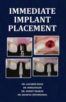 Immediate Implant Placement 8197792720 Book Cover