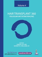 Hair Transplant 360: Follicular Unit Extraction (FUE) - Vol. 4 9352500369 Book Cover