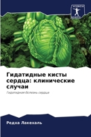 Гидатидные кисты сердца: 6205866749 Book Cover