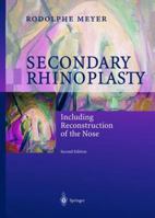 Secondary Rhinoplasty: Including Reconstruction of the Nose 3642630138 Book Cover