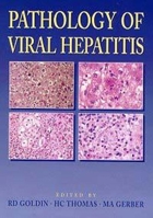 Pathology of Viral Hepatitis 0340596643 Book Cover
