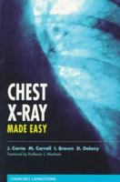 Chest X-Ray Made Easy