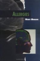 Allergies (Twenty-First Century Medical Library) 0761313591 Book Cover