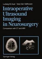 Intraoperative Ultrasound Imaging In Neurosurgery: Comparison With Ct And Mri 3540502580 Book Cover