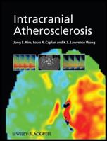 Intracranial Atherosclerosis 1405178221 Book Cover