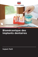 Biomécanique des implants dentaires 6202367369 Book Cover