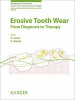 Erosive Tooth Wear: From Diagnosis to Therapy 3318025526 Book Cover