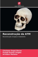 Reconstrução da ATM 620654530X Book Cover
