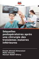 Séquelles postopératoires après une chirurgie des troisièmes molaires inférieures (French Edition) 6208884594 Book Cover