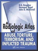 A Radiologic Atlas of Abuse, Torture, Terrorism, and Inflicted Trauma 0849315336 Book Cover