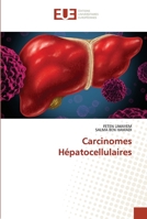 Carcinomes Hépatocellulaires 6203426989 Book Cover