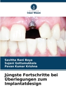 Jüngste Fortschritte bei Überlegungen zum Implantatdesign 620440993X Book Cover