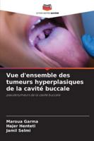 Vue d'ensemble des tumeurs hyperplasiques de la cavité buccale (French Edition) 6200449546 Book Cover