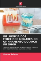 Influência DOS Terceiros Molares No Apinhamento Do Arco Inferior 6205629593 Book Cover