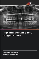 Impianti dentali e loro progettazione (Italian Edition) 6630196120 Book Cover