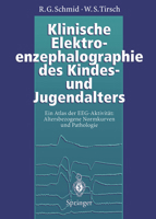 Klinische Elektroenzephalographie Des Kindes- Und Jugendalters: Ein Atlas Der Eeg-Aktivitat: Altersbezogene Normkurven Und Pathologie 3642793053 Book Cover