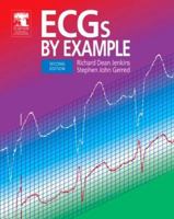 ECG's By Example 0443074100 Book Cover