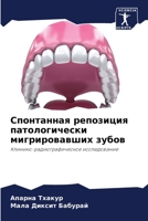 Спонтанная репозиция патологически мигр& 6204106295 Book Cover