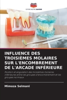 Influence Des Troisièmes Molaires Sur l'Encombrement de l'Arcade Inférieure 6205629585 Book Cover