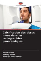 Calcification des tissus mous dans les radiographies panoramiques (French Edition) 6208274311 Book Cover