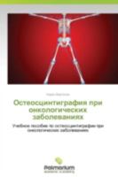 Osteostsintigrafiya Pri Onkologicheskikh Zabolevaniyakh 3659988367 Book Cover
