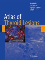 Atlas of Thyroid Lesions 1493940813 Book Cover