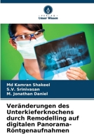 Veränderungen des Unterkieferknochens durch Remodelling auf digitalen Panorama-Röntgenaufnahmen (German Edition) 6208329167 Book Cover