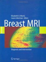 Breast MRI: Diagnosis and Intervention 0387219978 Book Cover
