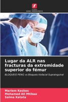 Lugar da ALR nas fracturas da extremidade superior do fémur (Portuguese Edition) 6206520609 Book Cover