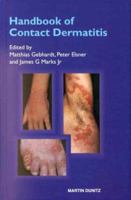 Handbook of Contact Dermatitis 1853178012 Book Cover