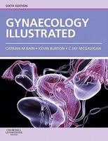 Gynaecology Illustrated 0702030678 Book Cover