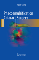 Phacoemulsification Cataract Surgery 3319599232 Book Cover