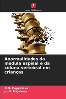 Anormalidades da medula espinal e da coluna vertebral em crianças 6205271273 Book Cover