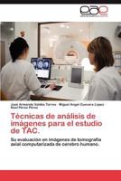 Técnicas de análisis de imágenes para el estudio de TAC.: Su evaluación en imágenes de tomografía axial computarizada de cerebro humano. 384735602X Book Cover