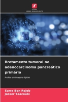 Brotamento tumoral no adenocarcinoma pancreático primário (Portuguese Edition) 6208634733 Book Cover