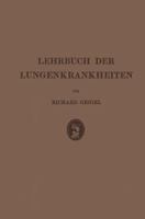 Lehrbuch Der Lungenkrankheiten 3662298163 Book Cover