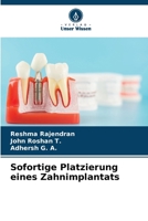 Sofortige Platzierung eines Zahnimplantats (German Edition) 6208299802 Book Cover